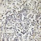 Anti-Lamin A/C (pS22) Antibody
